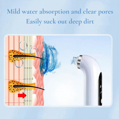 Electric Visual Pore Vacuum