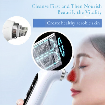 Electric Visual Pore Vacuum