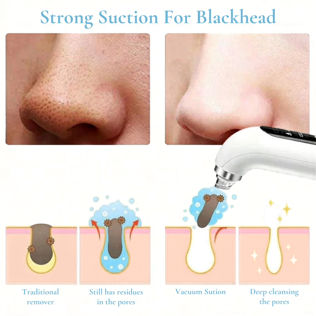 Electric Visual Pore Vacuum
