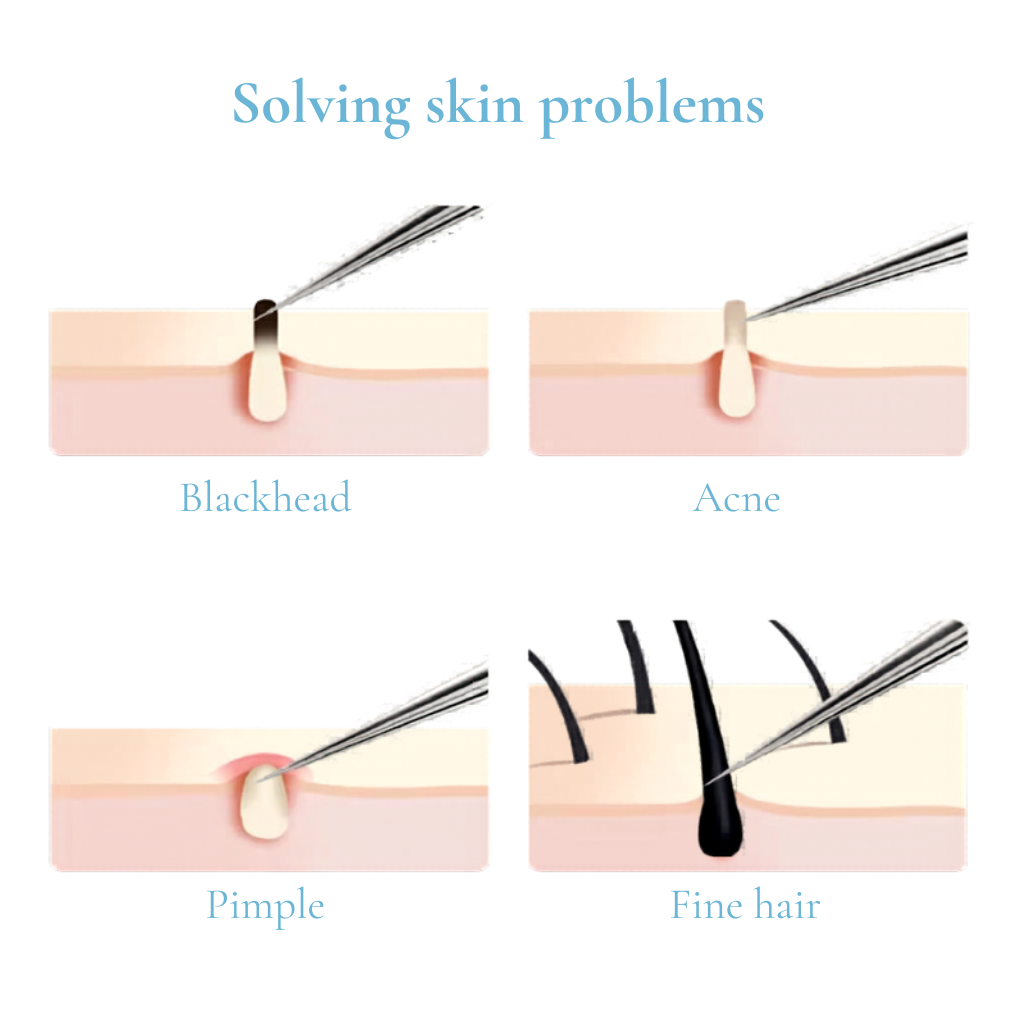 Professional Extraction Tool Kit