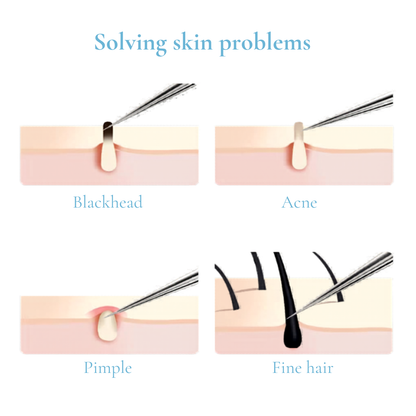 Professional Extraction Tool Kit